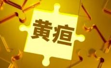 新生兒怎么看黃疸退了沒(méi)有 新生兒怎么看黃疸退了沒(méi)退